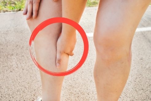 woman with varicose veins that are hurting a lot